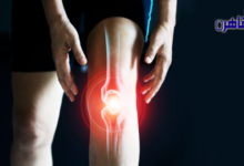 ما هي خشونة الركبة وعلاجها-العلاج الطبيعي لخشونة الركبة-علاج احتكاك الركب-أعراض احتكاك الركبة