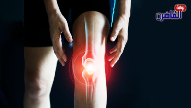 ما هي خشونة الركبة وعلاجها-العلاج الطبيعي لخشونة الركبة-علاج احتكاك الركب-أعراض احتكاك الركبة