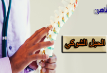 إصابات الحبل الشوكي والعلاج الطبيعي-الدكتور محمد سعد رضوان