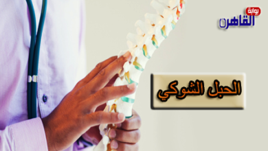 إصابات الحبل الشوكي والعلاج الطبيعي-الدكتور محمد سعد رضوان