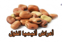 أعراض أنيميا الفول- علاج أنيميا الفول