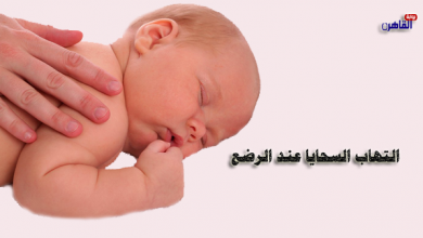 التهاب السحايا عند الرضع-أسباب التهاب السحايا عند الرضع-أعراض التهاب السحايا عند الرضع