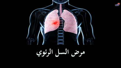 أعراض مرض السل خارج الرئة