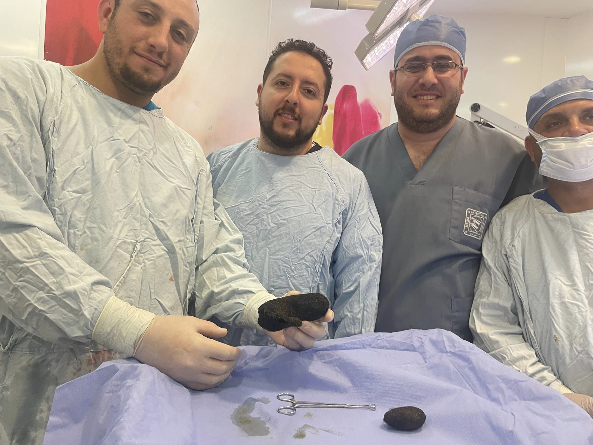 فريق جراحي بمستشفى أبو الريش ينجح في استخراج كتلتين شعر من أمعاء طفلة