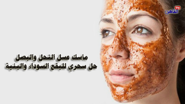 تجربتي مع البقع البنية في الوجه