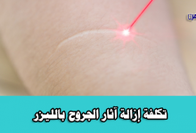تكلفة إزالة آثار الجروح بالليزر-إزالة آثار الجروح بالليزر