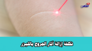 تكلفة إزالة آثار الجروح بالليزر-إزالة آثار الجروح بالليزر