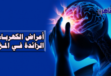 أعراض الكهرباء الزائدة في المخ-علاج الكهرباء الزائدة في المخ-أسباب الكهرباء الزائدة في المخ-تعريف الكهرباء الزائدة في المخ