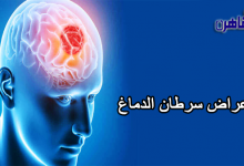 أعراض سرطان الدماغ