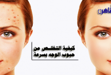 كيفية التخلص من حبوب الوجه بسرعة-كيفية العناية بالبشرة وتبيضها-وصفات لحبوب الوجه-سبب ظهور حبوب في الوجه-بثور الوجه