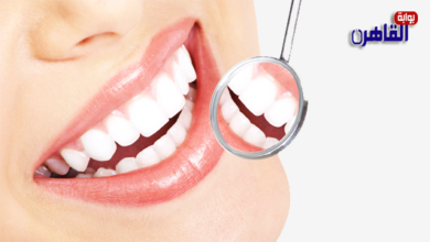 نصائح بعد تنظيف الأسنان من الجير-إزالة الجير من الأسنان عند الطبيب-بوابة القاهرة