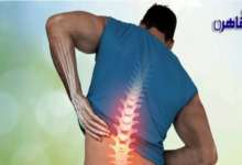 آلام العمود الفقري
