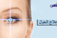 علاج الحول عند الكبار
